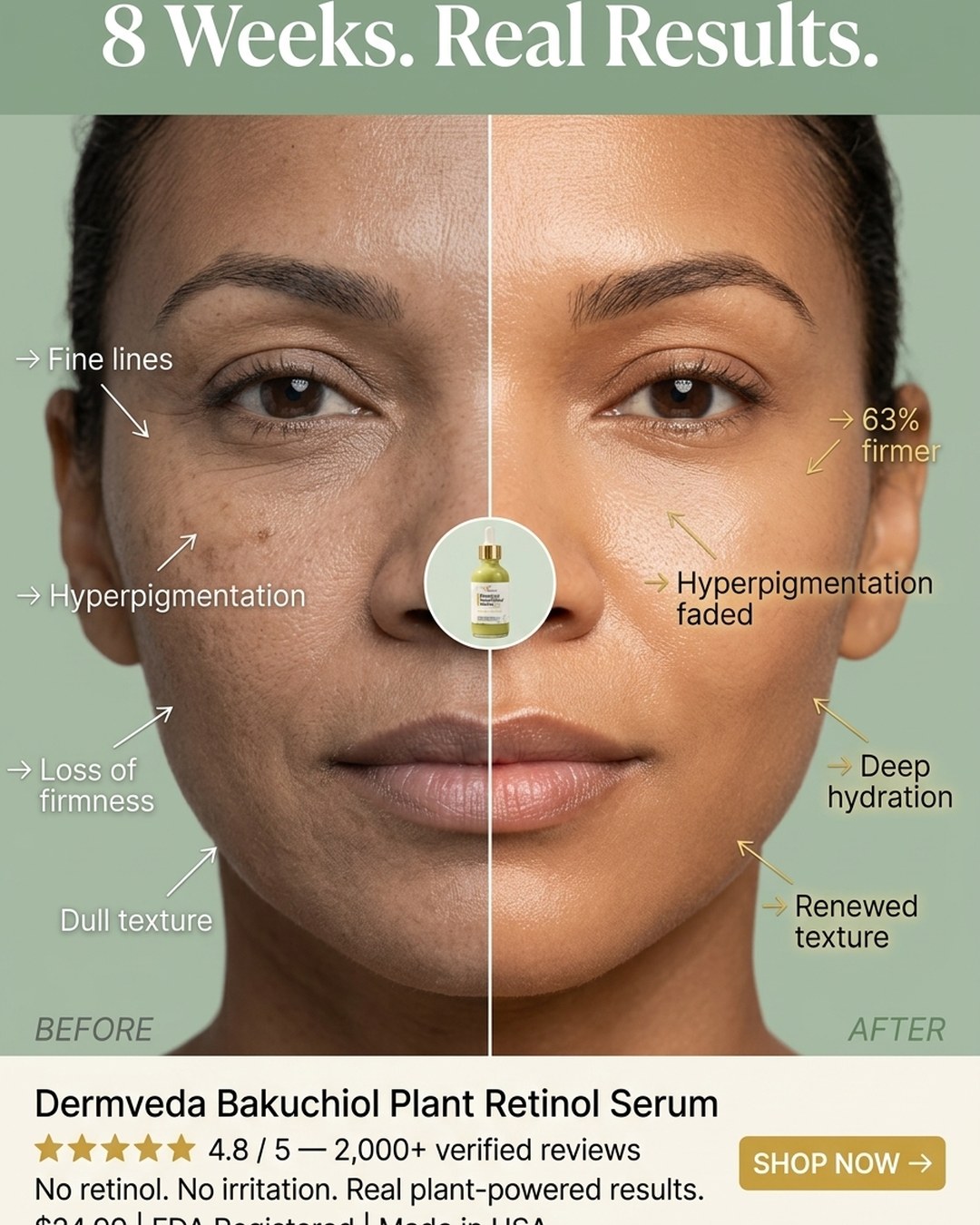 Bakuchiol serum before and after — 8 weeks real results, firmer skin, faded hyperpigmentation and renewed texture