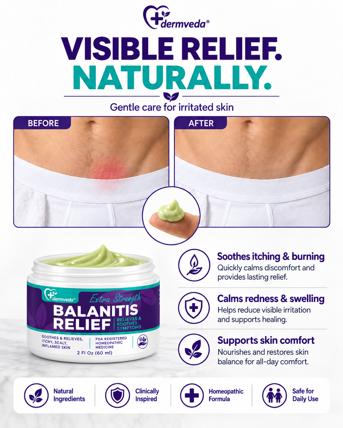 Balanitis cream before and after — visible reduction in redness and irritation of the affected external intimate area