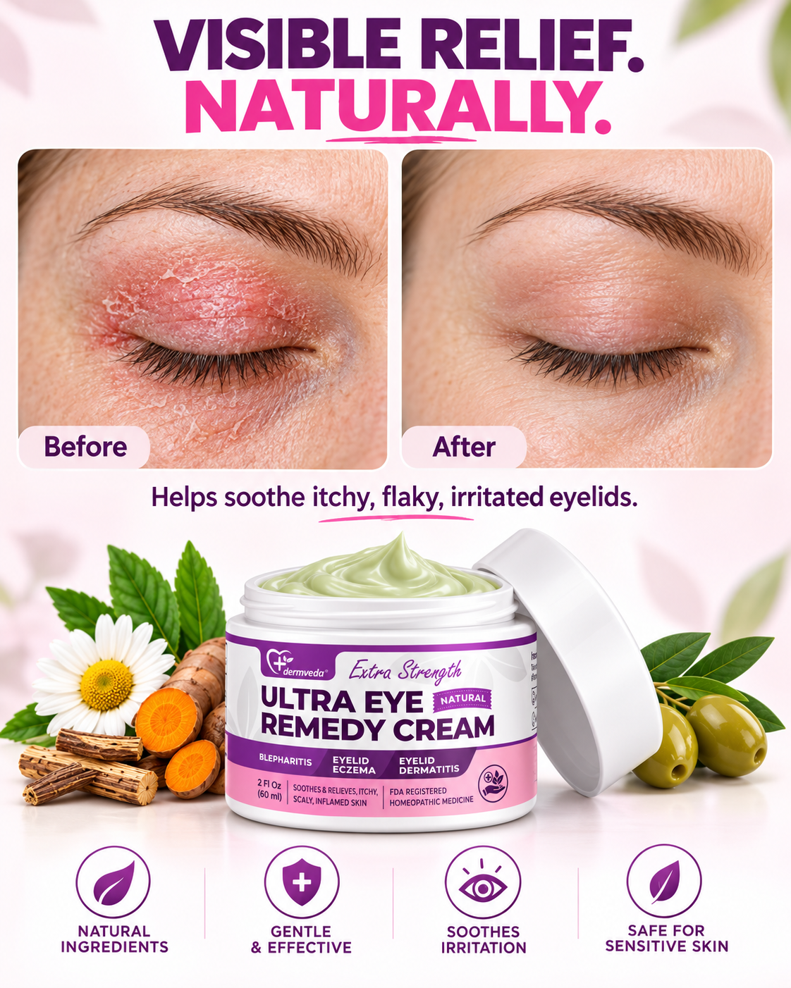 Before and after visible relief for itchy, flaky and irritated eyelids