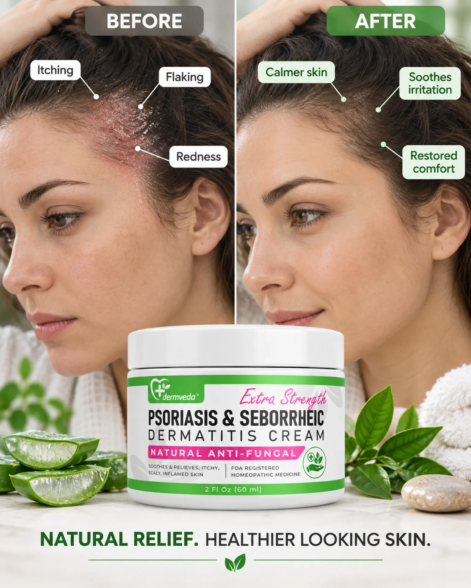 Before and after — calmer scalp skin with less itching, flaking and redness