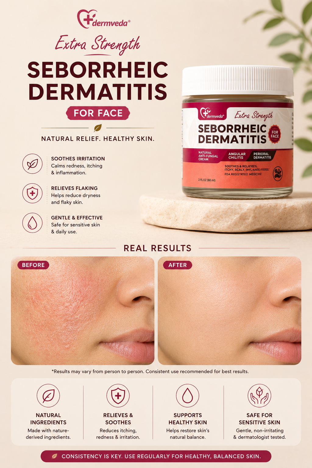 Visible relief and real results — before and after using Dermveda Angular Cheilitis Cream for 14 days