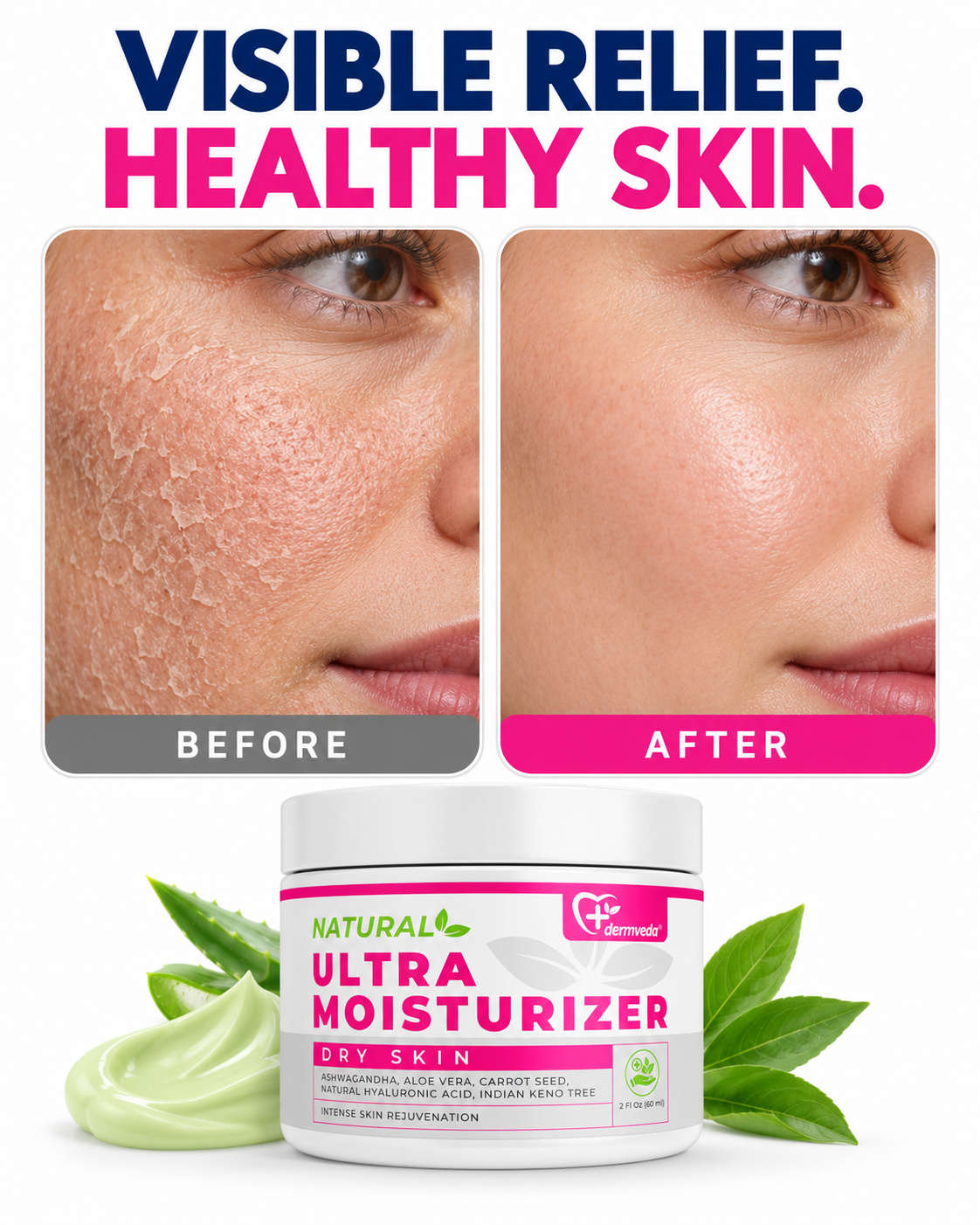Before and after using Dermveda Ultra Moisturizer for Dry Skin — visible relief from dry, peeling skin to smooth, healthy skin