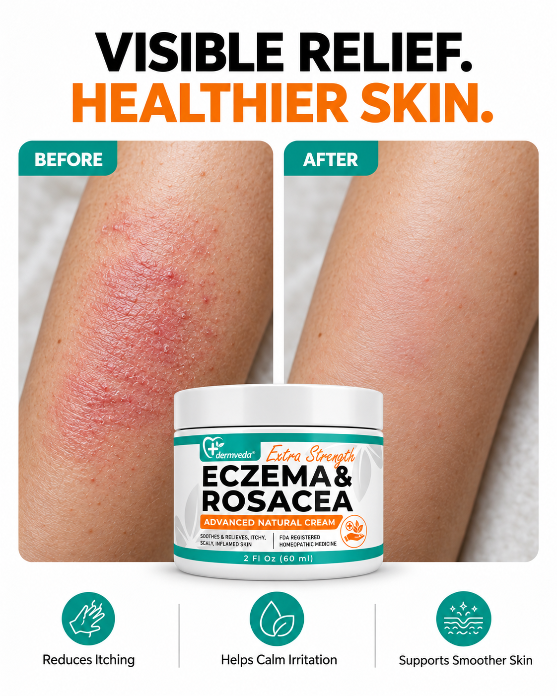 Before and after results with Dermveda Eczema and Rosacea Cream for visibly calmer, healthier-looking skin