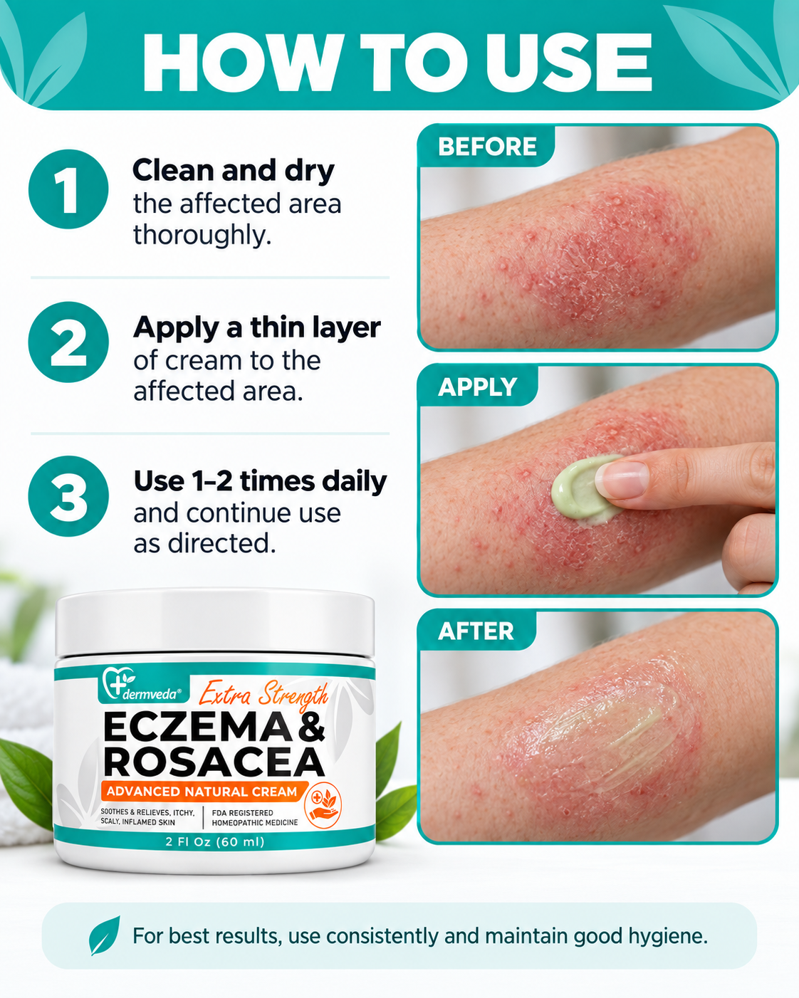 How to use Dermveda Eczema and Rosacea Cream in three simple steps