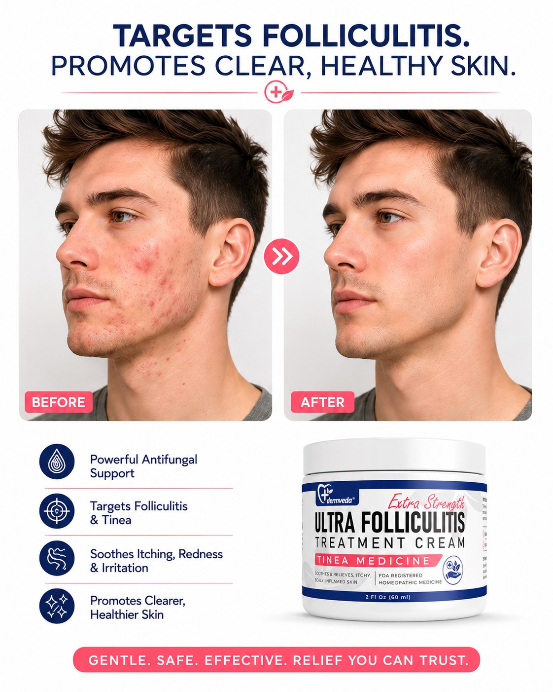 Before and after folliculitis treatment — red inflamed razor bumps cleared to smooth healthy skin