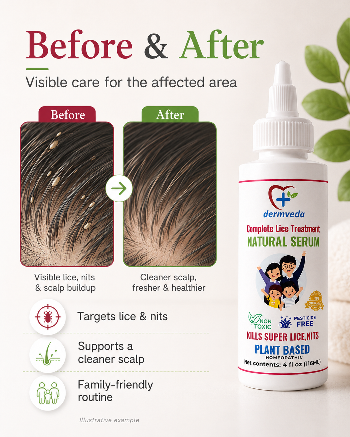 Before & after — cleaner, healthier scalp with Dermveda Complete Lice Treatment
