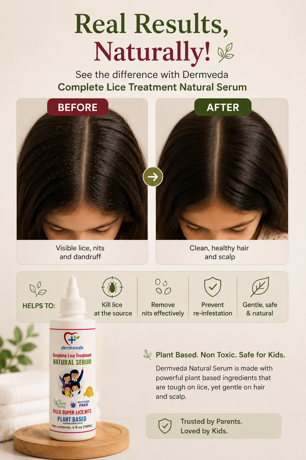 Before and after — visible lice and nits transformed into clean, healthy hair with Dermveda Natural Serum