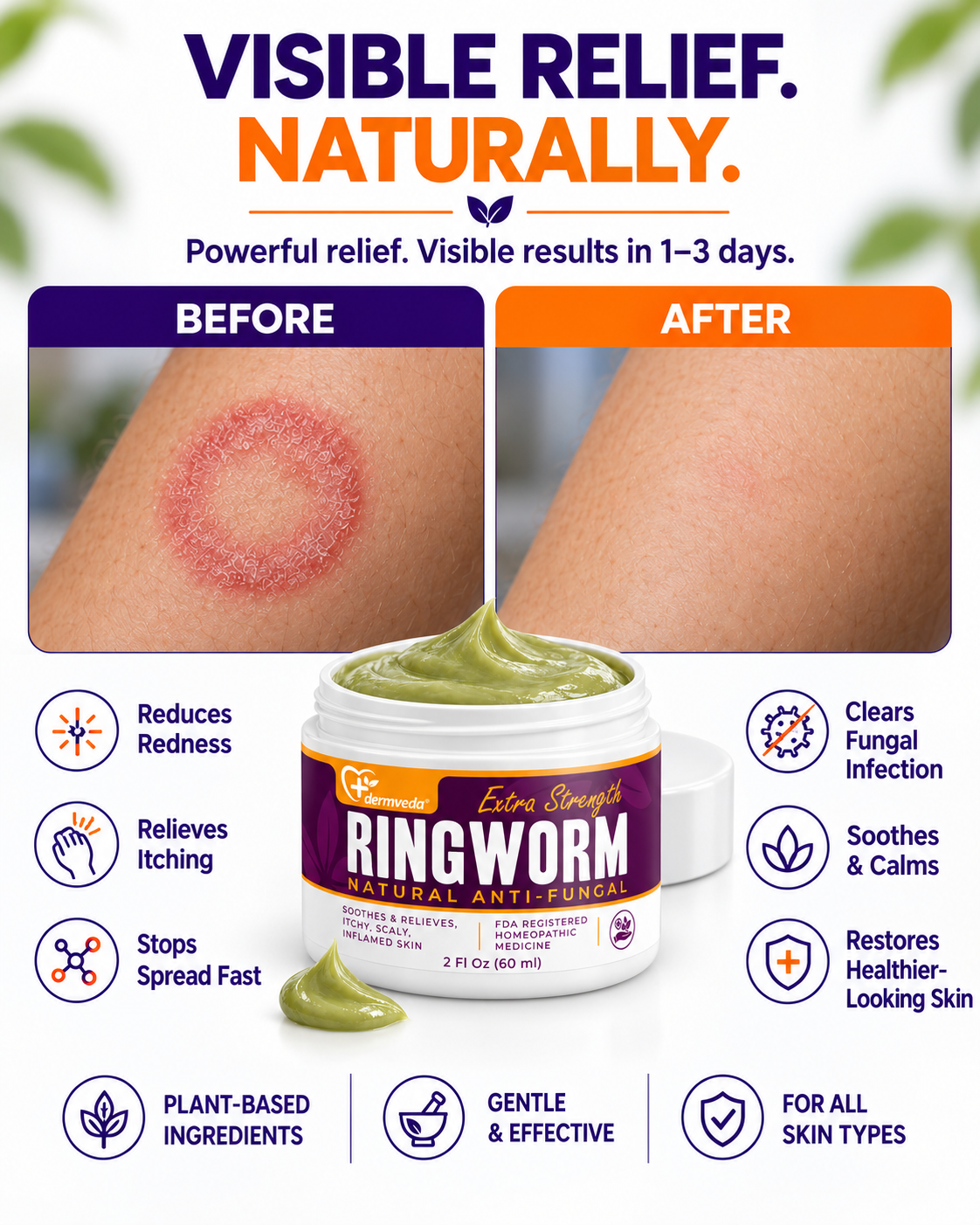 Before and after results from Dermveda Ringworm Cream