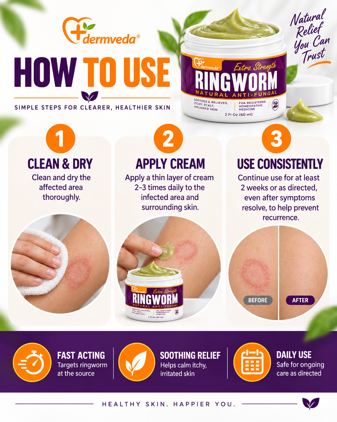 How to use Dermveda Ringworm Cream
